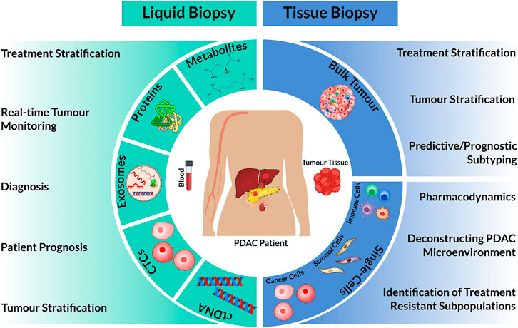 Pancreatic Cancer Drug Pipeline Analysis