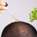 Regrow Confidence: PRP Hair Treatment in Islamabad