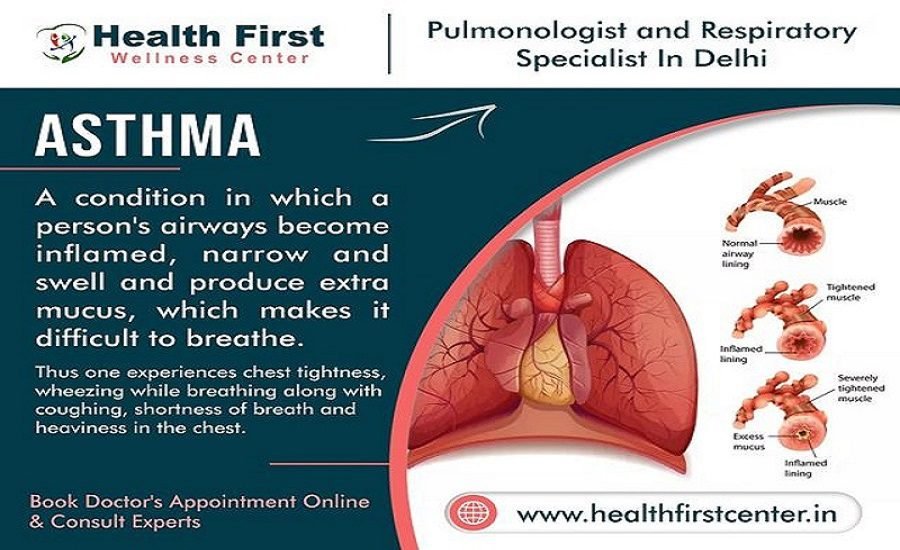 Asthma Specialist