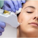 Rejuvenate Your Skin with Anti-Wrinkle Treatments and Botox in London