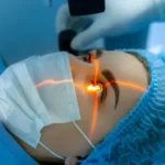 Squint Surgery for Adults and Kids: Key Differences to Understand