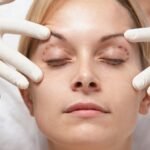 eyelid surgery new jersey