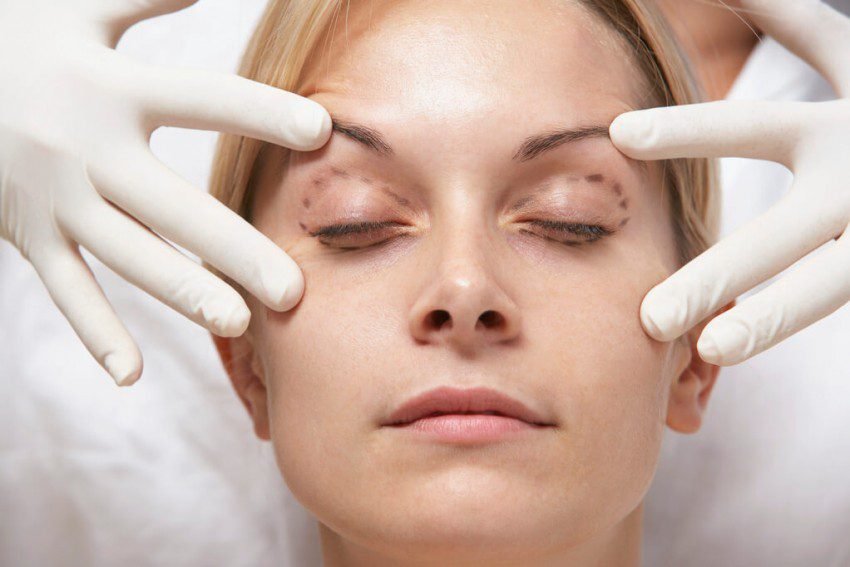 eyelid surgery new jersey