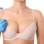 breast lift in dubai