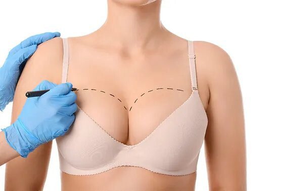 breast lift in dubai