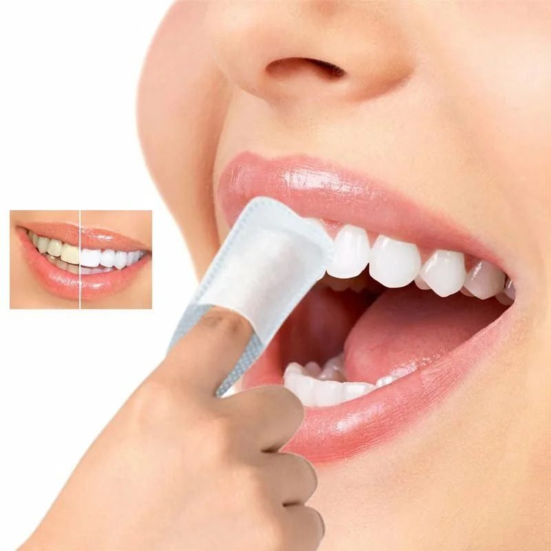 Dental Implants in Chennai