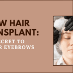 brow hair transplant