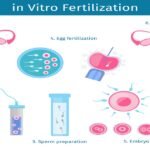 ivf