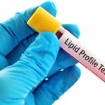 Lipid Profile Test