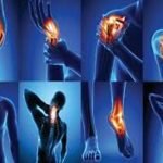 Chronic Pain: A Definition, Causes, Symptoms, and Treatments